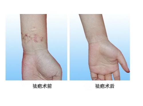 2023上海晶塑去痘印權(quán)威醫(yī)生榜單TOP10強(qiáng)(李科、陳杰、陳建君這些專家推薦給您)