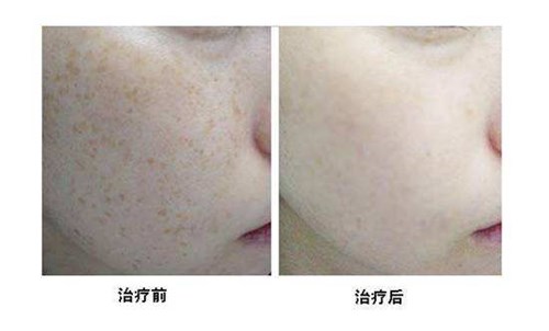 2023西昌專業(yè)腿部吸脂減肥手術(shù)正規(guī)專家口碑前十位(湯穎峰、吳強(qiáng)、劉光毓好評(píng)合集推薦)