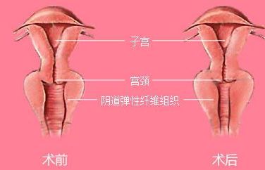 長沙靠譜矯正醫(yī)院哪家好？解答你所有的疑慮！