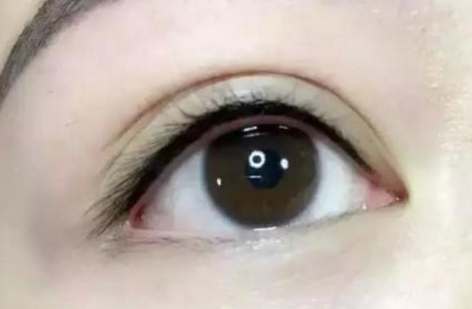 北京彤美做鼻子好的醫(yī)生推薦！口碑哪個醫(yī)生更靠譜？