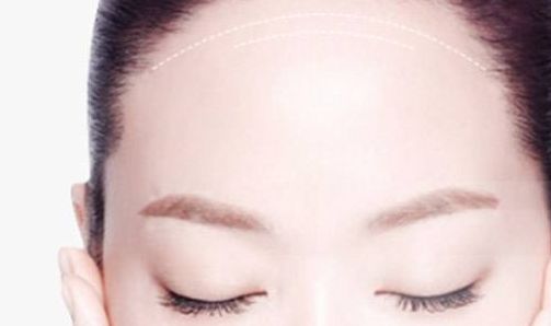 南京做修復(fù)雙眼皮哪家好？解析南京修復(fù)雙眼皮的最佳選擇