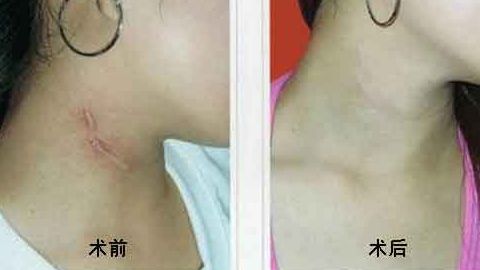 上海中西醫(yī)結合醫(yī)院整形美容科靠譜嗎？聽說口碑不錯！