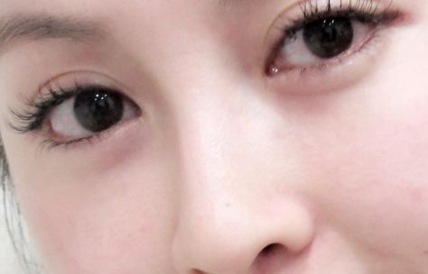 在烏魯木齊有哪些值得推薦的開(kāi)眼角好醫(yī)院？