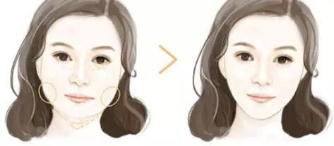 上海哪家下頜骨醫(yī)院好？解析上海下頜骨疾病常見病例及專業(yè)治療！