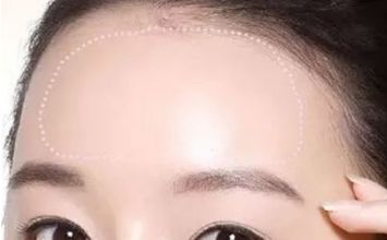 蘇州哪家黃褐斑醫(yī)院好？專(zhuān)業(yè)醫(yī)生推薦，讓你告別黃褐斑困擾！