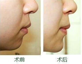 南寧整形豐胸醫(yī)院排名及評價互動：哪家醫(yī)院效果更好？