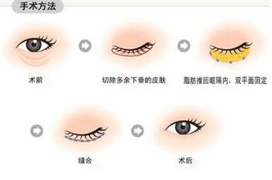 南寧治療痘印哪家醫(yī)院靠譜？—用戶首選南寧去痘印醫(yī)院排行榜
