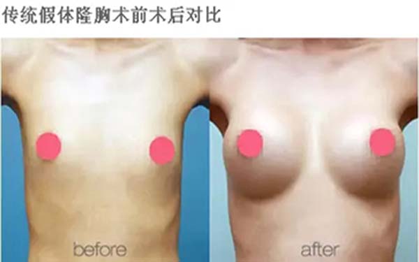 溫州雍禾醫(yī)院信譽(yù)如何？求推薦占家佳醫(yī)生植發(fā)效果如何？或溫州雍禾醫(yī)院口碑怎么樣？哪位醫(yī)生適合占家佳植發(fā)