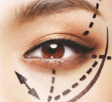 蘭州眼睛美容醫(yī)院哪家好？揭秘蘭州市最受歡迎的眼睛美容醫(yī)院排行榜！