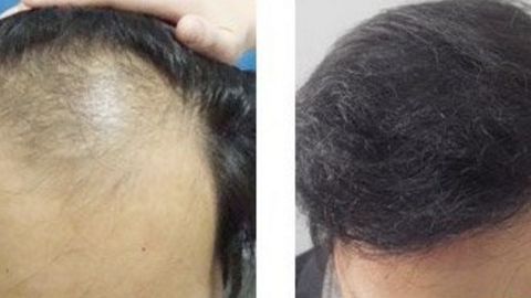 怡合醫(yī)院私密整形科有哪些資質(zhì)和口碑呢？