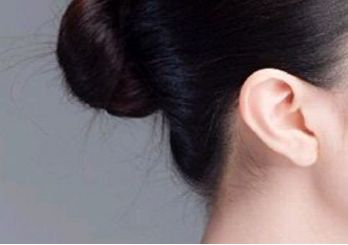 鄭州趙麗做雙眼皮修復(fù)效果如何？整形醫(yī)生背景和坐診情況請(qǐng)看！