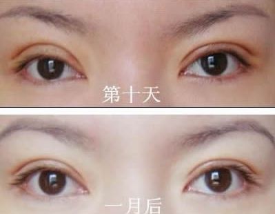 長春哪家醫(yī)院治痘痘好？了解長春市治療青春痘的?？漆t(yī)院及價格