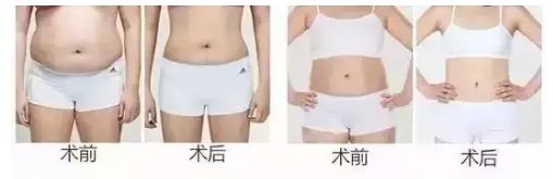 信陽去整形哪家醫(yī)院好？名副其實(shí)信陽市最佳整形醫(yī)院TOP推薦