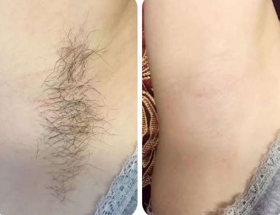 上海整形醫(yī)院哪家的好？最權(quán)威的排名榜單來幫你挑選！