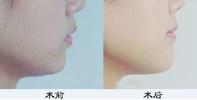 鄭州鼻綜合哪家醫(yī)院好？TOP醫(yī)療機構(gòu)大揭秘