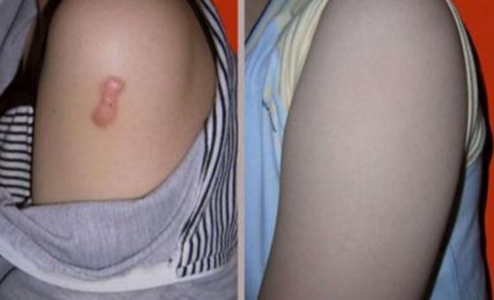 上海雙眼皮切開(kāi)手術(shù)，哪家醫(yī)院技術(shù)好且安全？