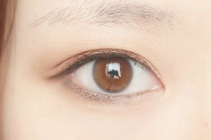 深圳北大醫(yī)院自體脂肪填充的效果如何？何君君醫(yī)生的資料和擅長特點分享！