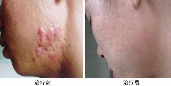 南京哪家醫(yī)院做兔唇手術(shù)效果好又安全？