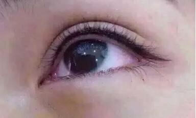 八大處整容醫(yī)院閆言皮膚性病治療的療效如何評價？