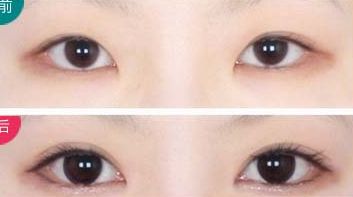 西安治療瘢痕哪家醫(yī)院好評(píng)不斷！
