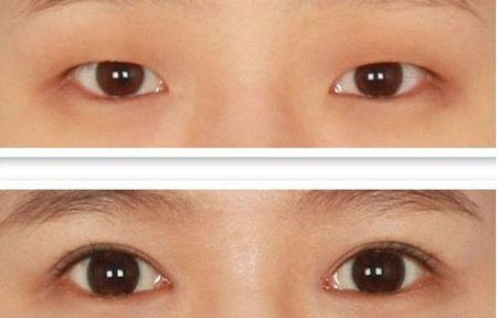 北京整容科好的醫(yī)院有哪些？中關(guān)村整形醫(yī)院綜合實力領(lǐng)先！