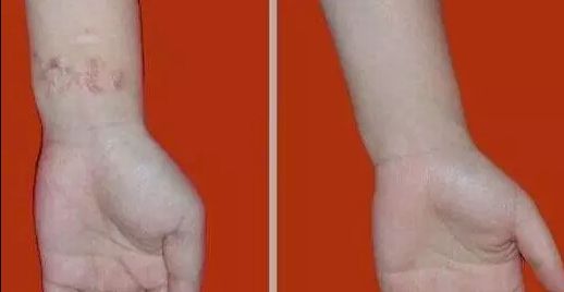 杭州哪家醫(yī)院看喉嚨好？排名最好的專業(yè)醫(yī)院推薦