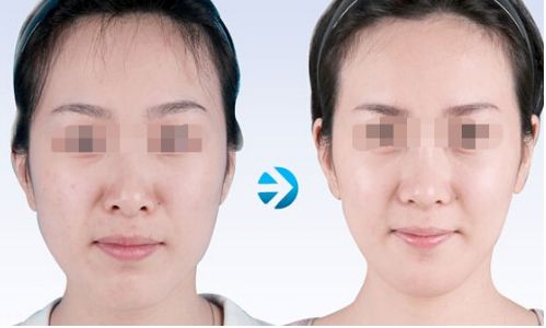 云南雙眼皮手術(shù)有哪些優(yōu)質(zhì)醫(yī)院值得推薦？