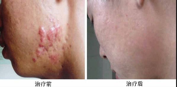 深圳哪家醫(yī)院隆胸效果好，費(fèi)用適中？