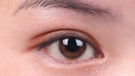 蘇州雙眼皮修復(fù)醫(yī)院排名及口碑，哪家醫(yī)院修復(fù)效果最好？