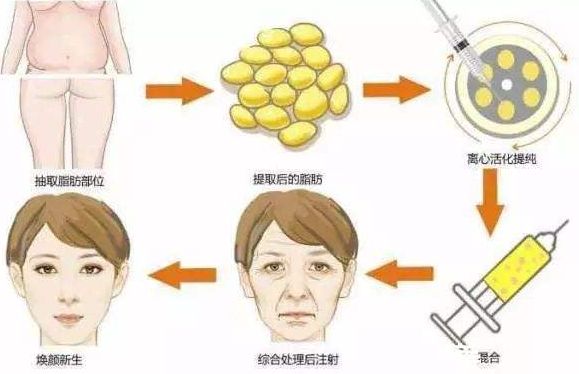 重慶整形磨骨哪家醫(yī)院好？整形醫(yī)院排行榜解讀，選擇最適合您的醫(yī)院！