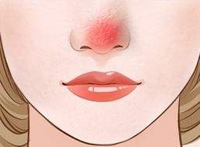 廣州最新開設(shè)的軍事美容整形醫(yī)院，王世虎是權(quán)威整形專家，手術(shù)價(jià)便宜