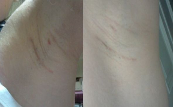 恩施地區(qū)有哪些信譽好的美容整形醫(yī)院？