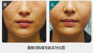 錦州整形美容醫(yī)院哪家靠譜？醫(yī)療技術(shù)如何？