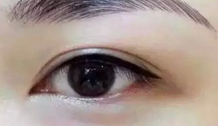 鄭州美麗時光醫(yī)療整形美容醫(yī)院費用如何？評論怎么樣？整容前必讀！