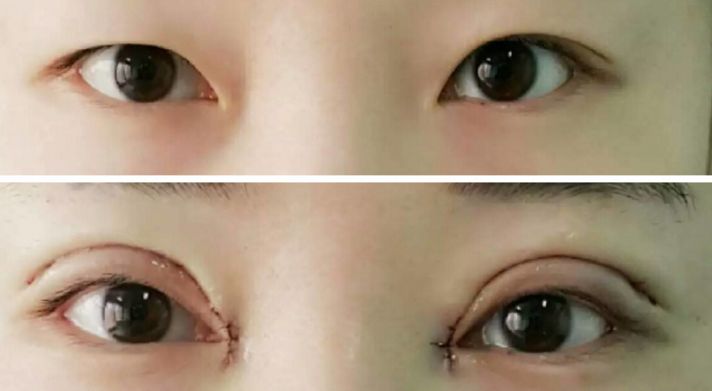 貴陽哪家醫(yī)院熱瑪吉效果好，值得推薦？