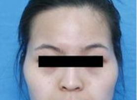 成都治療臉上痘痘哪家醫(yī)院好？專家推薦的成都治痘好醫(yī)院大揭秘！