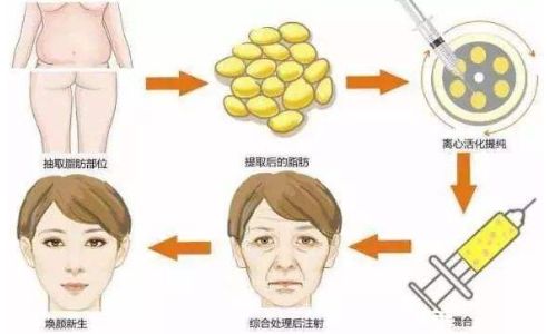 鄭州鼻整形哪家醫(yī)院好？一篇權(quán)威評(píng)測(cè)解答你的疑惑！