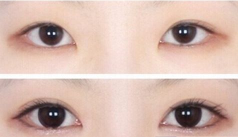 濟(jì)南哪家醫(yī)院的豐胸手術(shù)效果最好？