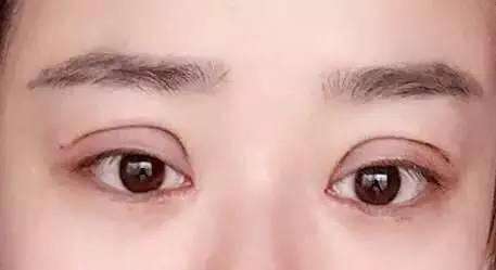 2023廣州乳房下垂上提口碑醫(yī)生(馮雪貞、王鋒、盧仕良既權(quán)威技術(shù)又先進(jìn))
