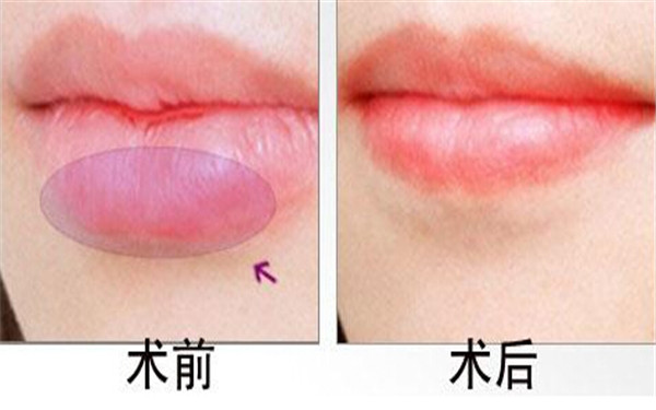 2023常德平滑吸脂瘦身評(píng)分十強(qiáng)醫(yī)生(陳勇、肖世錦、李進(jìn)進(jìn)這些專(zhuān)家口碑靠前)