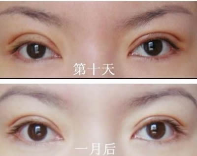 2023洛陽額頭打除皺針在榜單前十位醫(yī)生(劉戰(zhàn)輝、黃浩浩、周先華手法嫻熟自然)