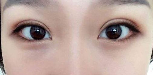 永州地區(qū)哪家正規(guī)整形醫(yī)院好？