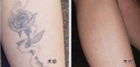 不二選擇！上海鼻修復(fù)專家徐永豐、劉仁輝搶占熱門名單成功！個人實力攀升不可阻擋！
