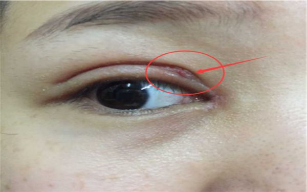 蘇州隆胸哪家醫(yī)院好？專業(yè)醫(yī)師為您分析