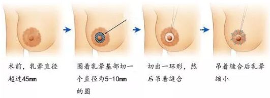 在哈爾濱做除皺哪家醫(yī)院好？選擇專(zhuān)業(yè)除皺醫(yī)生，享受高質(zhì)量護(hù)理服務(wù)