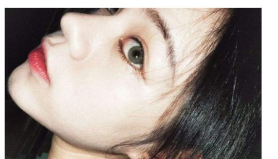 找一家靠譜的汕頭去除疤痕醫(yī)院？看這里！