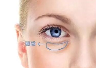 蘇州哪家醫(yī)院治療黃褐斑效果好？