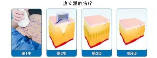 上海臉部祛斑哪家醫(yī)院好？揭秘上海市最受歡迎臉部祛斑醫(yī)院排行榜