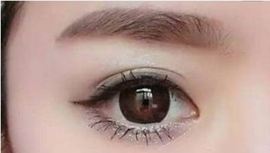 沈正洲如何進行雙眼皮手術？醫(yī)生介紹、手術費用、成功案例、患者口碑分享