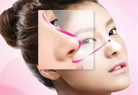 深圳駝峰鼻矯正哪家好？專業(yè)醫(yī)生推薦與真實(shí)案例分享！